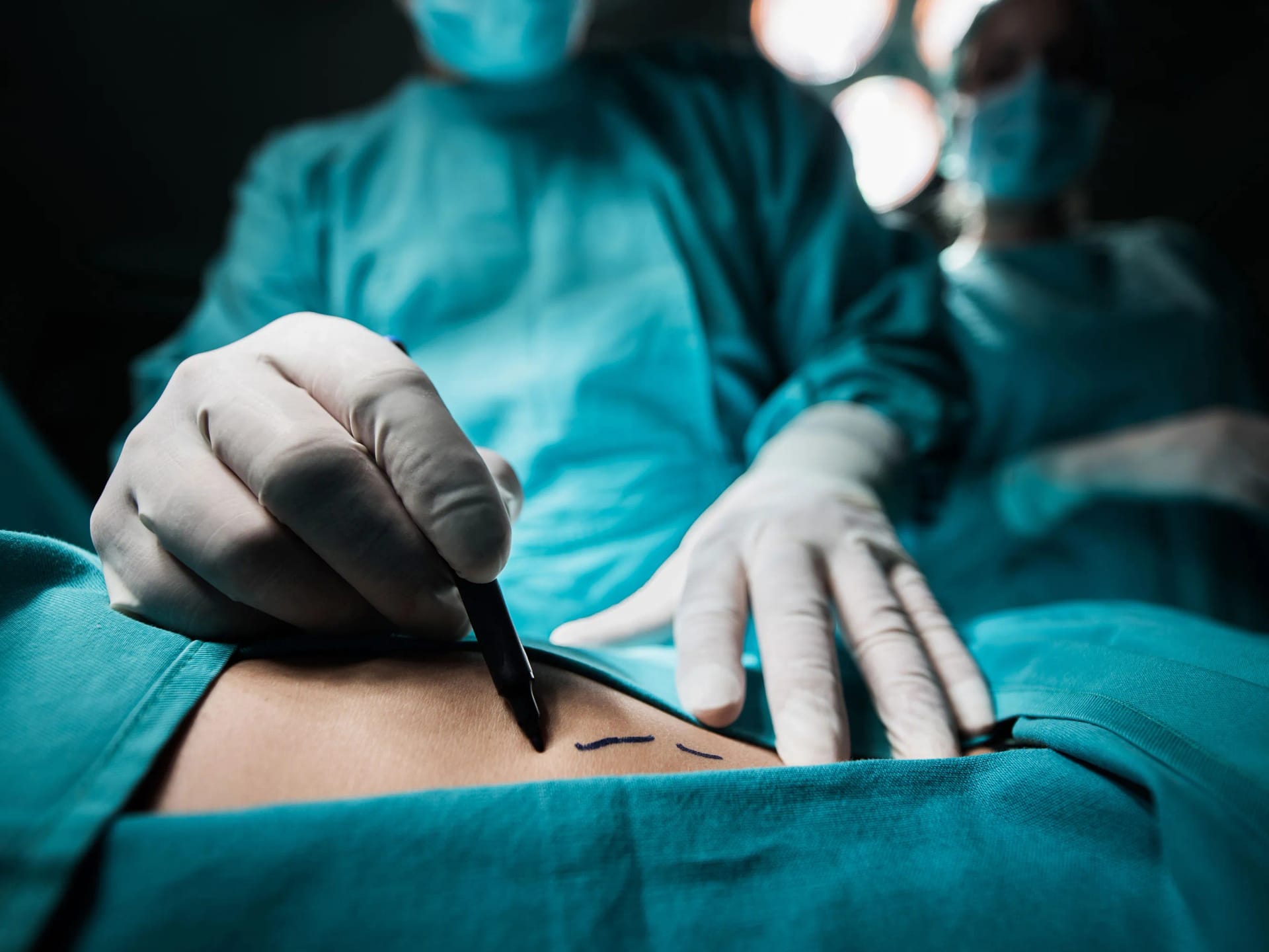Brustverkleinerung und ihre Bedeutung für das persönliche Wohlgefühl