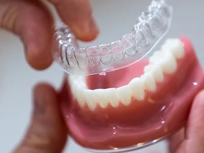 Erfolgsgeschichten: Transformationen im echten Leben mit transparenten Alignern