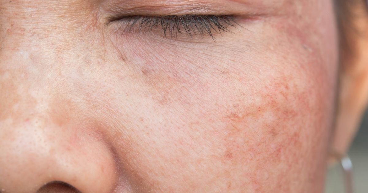 Moderne Anwendungen für filler face – Schönheit neu definiert